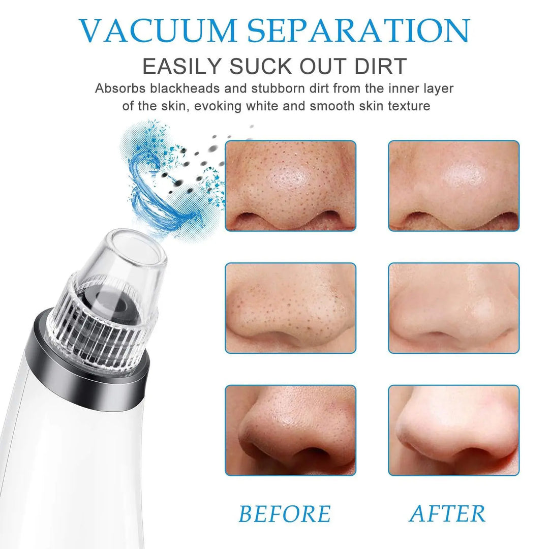 Blackhead Remover Face Nose  Pore Acne Pimple Removal Beauty Tool SP - Shakefav.com