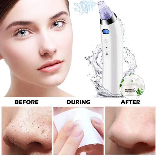 Electronic Blackhead Vacuum Cleaner Facial Pore Cleaner Extractor SP - Shakefav.com