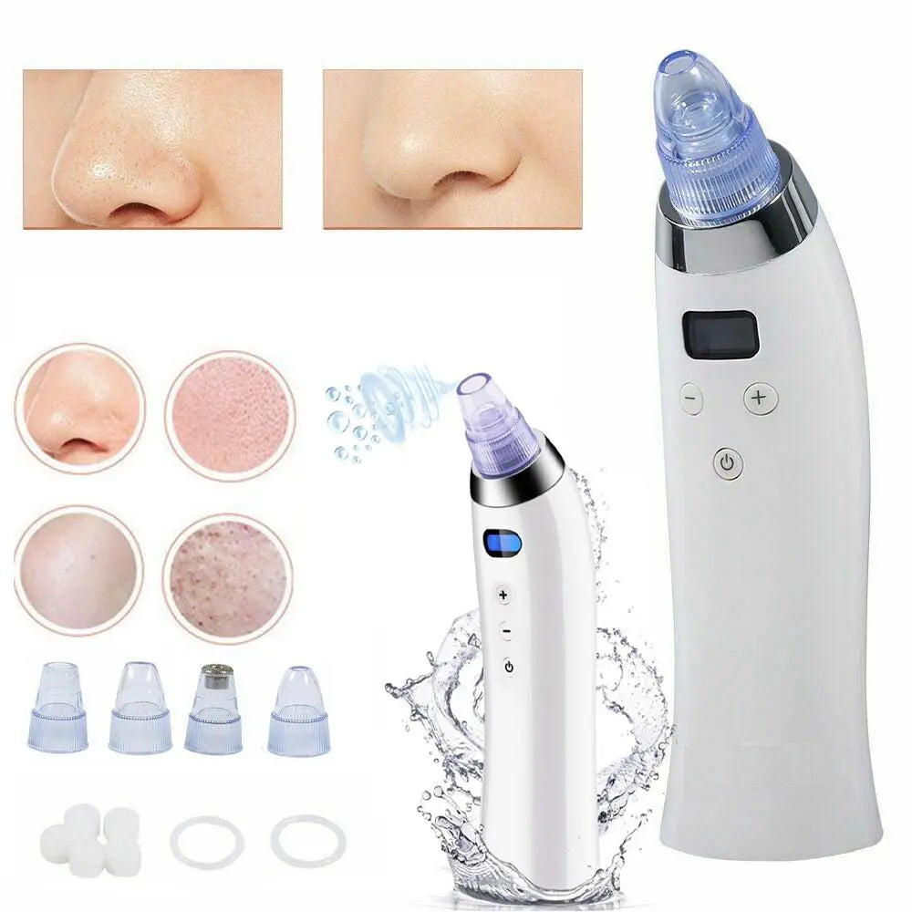 Electronic Blackhead Vacuum Cleaner Facial Pore Cleaner Extractor SP - Shakefav.com