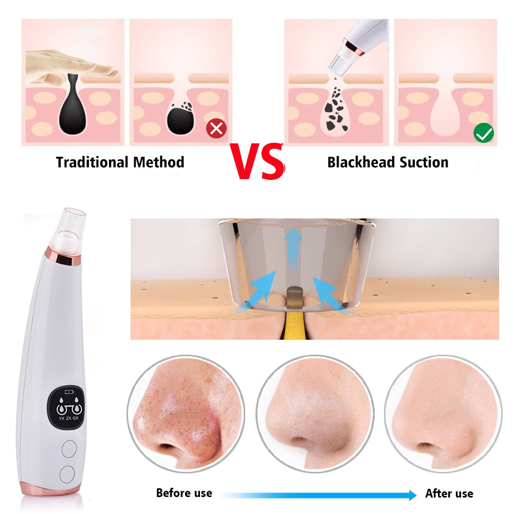 Vacuum Pore Cleaner Skin Care Standard