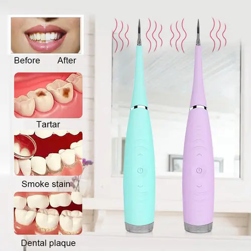 Electric Sonic Dental Tooth Calculus Remover Tooth Stains Cleaner - Shakefav.com