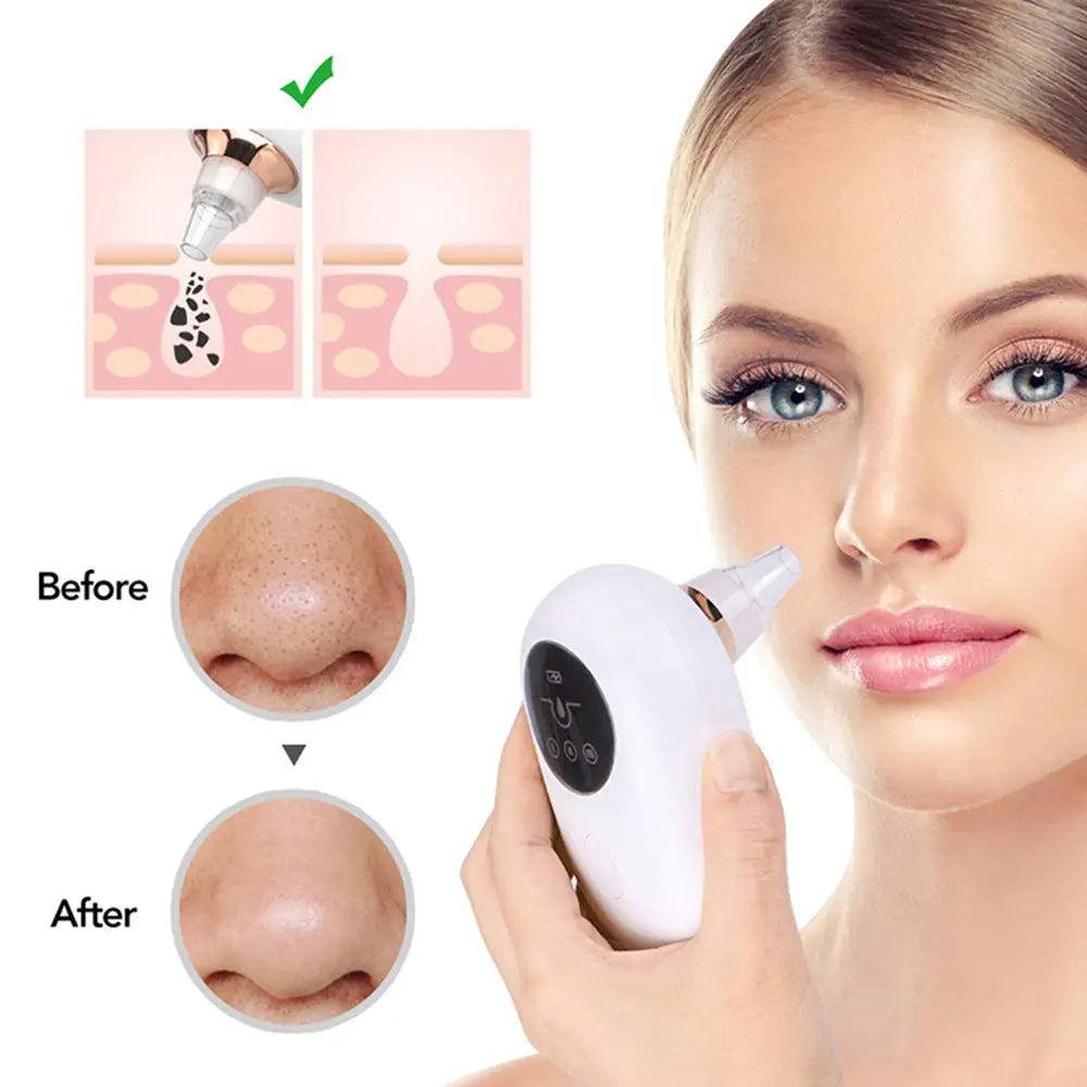 Portable  Face Deep Pore Cleaner Vacuum Blackhead Remover - Shakefav.com