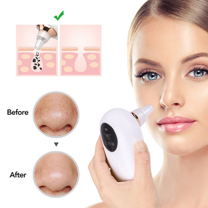 Nettoyeur portatif de pores profonds pour le visage, dissolvant de points noirs sous vide