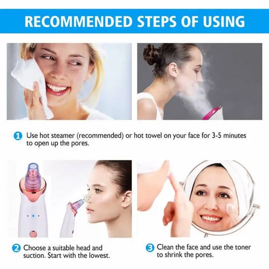 Electric Skin blackhead Vacuum Facial Blackhead Remover - Shakefav.com