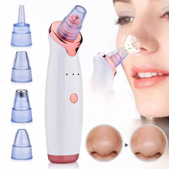 Electric Skin blackhead Vacuum Facial Blackhead Remover - Shakefav.com