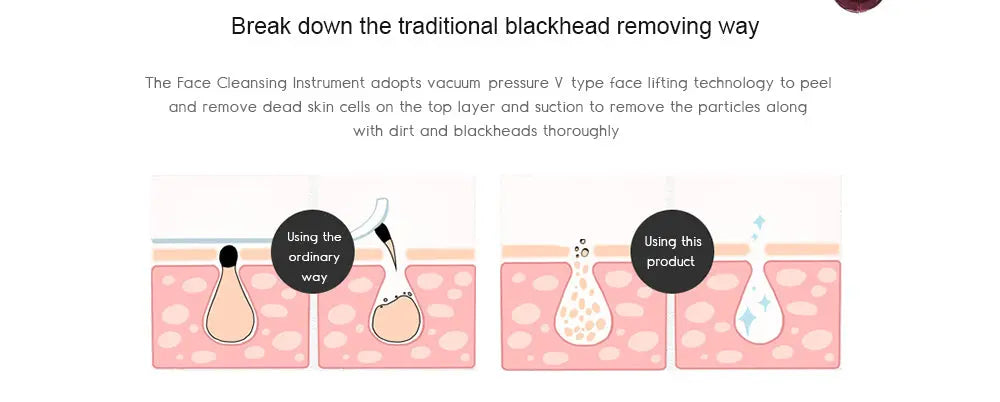 Electric Acne Blackhead Remover Skin Vacuum - Shakefav.com