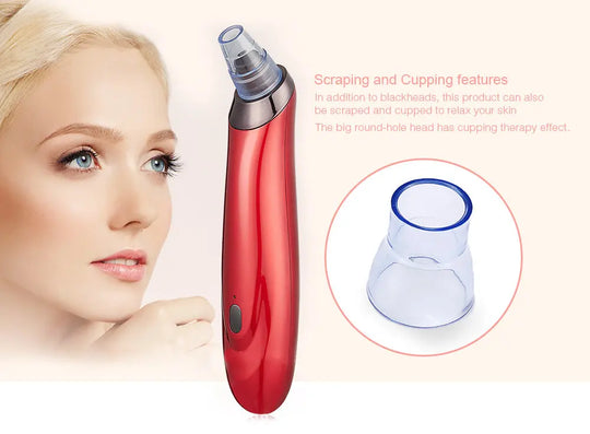 Electric Acne Blackhead Removeing Skin Vacuum - Shakefav.com