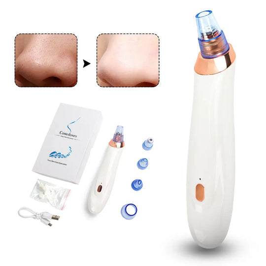 Electric Acne Remover Blackhead Removing Apparatus - Shakefav.com