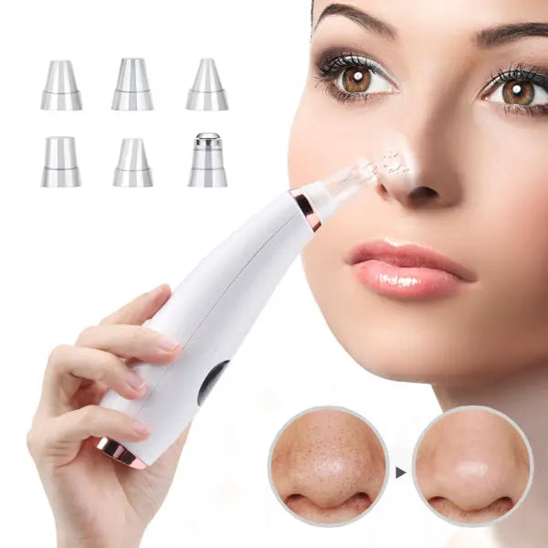 Facial microcry stalline blackhead skin beauty instrument - Shakefav.com