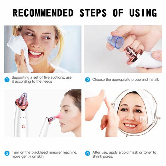 Facial Blackhead Remover Electric Vacuum Machine - Shakefav.com